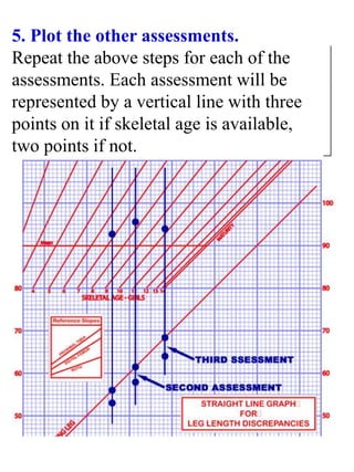 5. Plot the other assessments.
Repeat the above steps for each of the
assessments. Each assessment will be
represented by a vertical line with three
points on it if skeletal age is available,
two points if not.
 