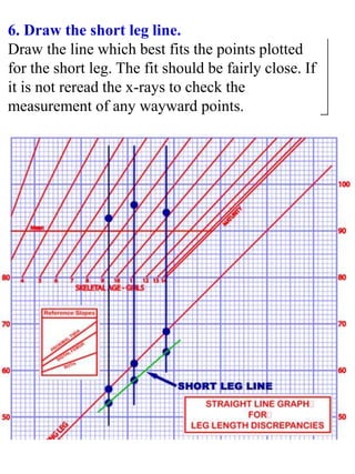 6. Draw the short leg line.
Draw the line which best fits the points plotted
for the short leg. The fit should be fairly close. If
it is not reread the x-rays to check the
measurement of any wayward points.
 