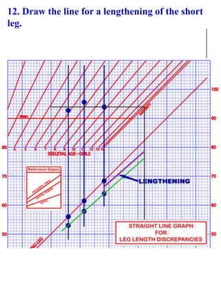 12. Draw the line for a lengthening of the short
leg.
 