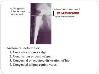 • Anatomical deformities:
1. Coxa vara or coxa valga
2. Genu varum or genu valgum
3. Congenital or acquired dislocation of hip
4. Congenital talipus equino varus
 
