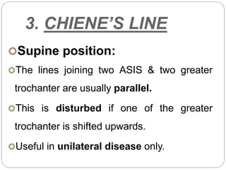 3. CHIENE’S LINE
Supine position:
The lines joining two ASIS & two greater
trochanter are usually parallel.
This is disturbed if one of the greater
trochanter is shifted upwards.
Useful in unilateral disease only.
 