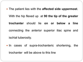  The patient lies with the affected side uppermost.
With the hip flexed up at 90 the tip of the greater
trochanter should lie on or below a line
connecting the anterior superior iliac spine and
ischial tuberosity.
 In cases of supra-trochanteric shortening, the
trochanter will be above to this line
 