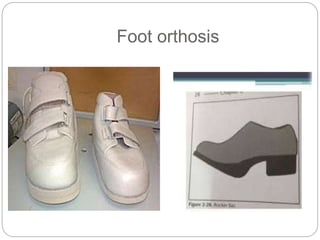 Foot orthosis
 