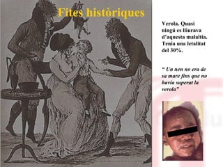 Fites històriques Verola. Quasi ningú es lliurava d’aquesta malaltia. Tenia una letalitat del 30%. “  Un nen no era de sa mare fins que no havia superat la verola” 