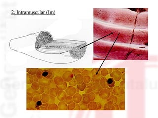2. Intramuscular (Im) 