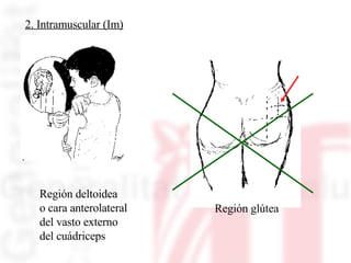 2. Intramuscular (Im) Región deltoidea  o cara anterolateral  del vasto externo  del cuádriceps Región glútea 