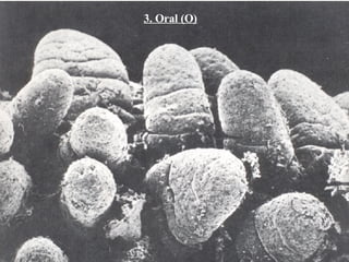3. Oral (O) 
