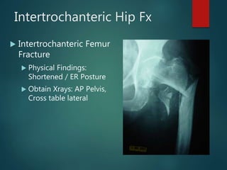 Intertrochanteric Hip Fx
 Intertrochanteric Femur
Fracture
 Physical Findings:
Shortened / ER Posture
 Obtain Xrays: AP Pelvis,
Cross table lateral
 