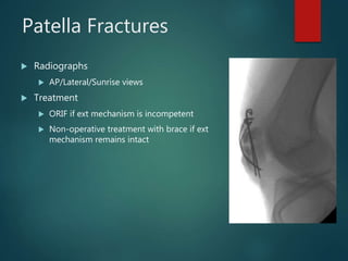 Patella Fractures
 Radiographs
 AP/Lateral/Sunrise views
 Treatment
 ORIF if ext mechanism is incompetent
 Non-operative treatment with brace if ext
mechanism remains intact
 