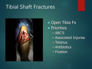 Tibial Shaft Fractures
 Open Tibia Fx
 Priorities
– ABC’S
– Associated Injuries
– Tetanus
– Antibiotics
– Fixation
 