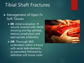 Tibial Shaft Fractures
 Management of Open Fx
Soft Tissues
 ER: initial evaluation 
wound covered with sterile
dressing and leg splinted,
tetanus prophylaxis and
appropriate antibiotics
 OR: Thorough I&D
undertaken within 6 hours
with serial debridements
as warranted followed by
definitive soft tissue cover
 