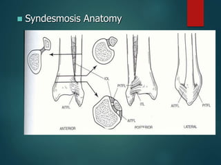 Syndesmosis Anatomy
 