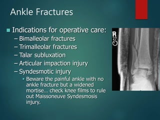 Ankle Fractures
 Indications for operative care:
– Bimalleolar fractures
– Trimalleolar fractures
– Talar subluxation
– Articular impaction injury
– Syndesmotic injury
 Beware the painful ankle with no
ankle fracture but a widened
mortise… check knee films to rule
out Maissoneuve Syndesmosis
injury.
 