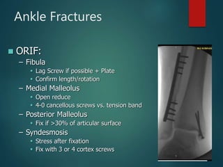 Ankle Fractures
 ORIF:
– Fibula
 Lag Screw if possible + Plate
 Confirm length/rotation
– Medial Malleolus
 Open reduce
 4-0 cancellous screws vs. tension band
– Posterior Malleolus
 Fix if >30% of articular surface
– Syndesmosis
 Stress after fixation
 Fix with 3 or 4 cortex screws
 