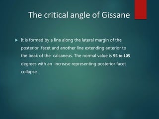 The critical angle of Gissane
 It is formed by a line along the lateral margin of the
posterior facet and another line extending anterior to
the beak of the calcaneus. The normal value is 95 to 105
degrees with an increase representing posterior facet
collapse
 