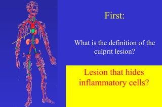 129 inflammation and culprit lesions