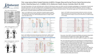 Title: Long-Latency Motor Evoked Potentials (LLMEPs): Changes Observed During Thoracic Spinal Reconstruction
Author: David Barnkow, Au.D., D.ABNM, CCC-A, Medsurant Health, Denver, Colorado, March 28, 2019
The Case Presentation: A 61 year-old female with a history of mid-thoracic spinal cord infarct and C8 incomplete quadriplegia as a complication of spinal cord
stimulator placement. The chief complaints were increasing hand numbness and weakness, low back and lower extremity spasticity, and loss of range of
motion in the lower extremities. Her diagnoses included T10 vertebral collapse and spinal stenosis. The planned surgery was T10 corpectomy and interbody
graft, and T4- S1 revision posterior spine fusion and instrumentation.Table 1. Motor Strength Assessment
Figure 1. Sensory Assessment – Pin Prick
Figure 2. Left TceMEPs prior to incision. Identification of possible repetitive myogenic
activity beyond 200 ms prompts Neurophysiologist to expand recording window to 300
ms. Normal latency MEPs in red. LLMEP extending beyond 200 ms in orange. LLMEPs
greater than 200 ms in blue.
Figure 3. Left TceMEPs during thoracic decompressive laminectomies. LLMEPs (orange)
emerge before TceMEPs. Conventional TceMEPs (red) persist after LLMEP disappear.
Discussion: Ulnar SSEPs remained identifiable and posterior tibial SSEPs
remained absent throughout the surgery. Right side TceMEPs
demonstrated data similar to left side TceMEPs throughout the surgery.
This case study demonstrates that expanding the recording window of
current standard TceMEP protocols beyond 200 ms can reveal another
category of motor evoked potentials, the LLMEP. The disappearance of
the LLMEPs during a surgical period presumed to improve
neurophysiologic function is interesting. While the underlying
mechanisms and clinical utility of LLMEPs have not been described, this
author encourages all clinicians to consider expanding their recording
window to collect possible LLMEPs, and to publish and share their
LLMEP findings for a greater meta-analysis of this interesting, yet
essentially undescribed, phenomenon.
Figure 4. Left TceMEPs during instrumentation, deformity correction, and closing.
Note the persistence of the conventional TceMEPs (red). Also note the absence of
LLMEPs in VM and AbH montages, and pronounced intermittency of LLMEPs (orange)
in TA montage.
Figure 2. Sensory Assessment - Light Touch
 