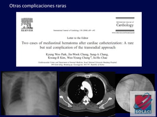 Otras complicaciones raras
 