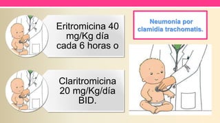 Neumonía por
clamidia trachomatis.Eritromicina 40
mg/Kg día
cada 6 horas o
Claritromicina
20 mg/Kg/día
BID.
 