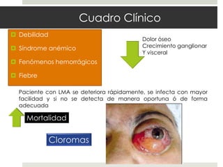 Cuadro Clínico
 Debilidad
                                           Dolor óseo
 Síndrome anémico                         Crecimiento ganglionar
                                           Y visceral
 Fenómenos hemorrágicos

 Fiebre

  Paciente con LMA se deteriora rápidamente, se infecta con mayor
  facilidad y si no se detecta de manera oportuna ó de forma
  adecuada

    Mortalidad
 