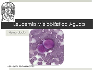 Leucemia Mieloblástica Aguda
 Hematología




Luis Javier Rivera Morales
 