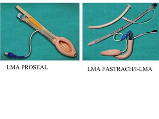 Lma Visualization LMA - Final.pptx