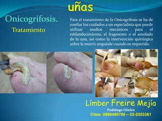 Onicogrifosis.
Tratamiento

Para el tratamiento de la Onicogrifosis se ha de
confiar los cuidados a un especialista que puede
utilizar
medios
mecánicos
para
el
reblandecimiento, el fragmento o el amolado
de la una, así como la intervención quirúrgica
sobre la matriz unguéale cuando es requerida.

Límber Freire Mejía
Podólogo Clínico

Citas: 0999490709 – 02-2553361

 