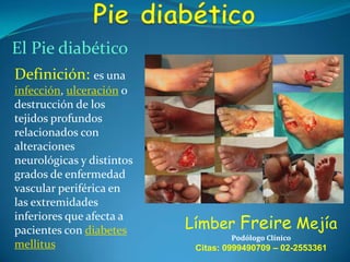El Pie diabético
Definición: es una
infección, ulceración o
destrucción de los
tejidos profundos
relacionados con
alteraciones
neurológicas y distintos
grados de enfermedad
vascular periférica en
las extremidades
inferiores que afecta a
pacientes con diabetes
mellitus

Límber Freire Mejía
Podólogo Clínico

Citas: 0999490709 – 02-2553361

 