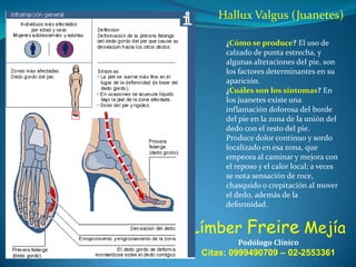 Hallux Valgus (Juanetes)
¿Cómo se produce? El uso de
calzado de punta estrecha, y
algunas alteraciones del pie, son
los factores determinantes en su
aparición.
¿Cuáles son los síntomas? En
los juanetes existe una
inflamación dolorosa del borde
del pie en la zona de la unión del
dedo con el resto del pie.
Produce dolor continuo y sordo
localizado en esa zona, que
empeora al caminar y mejora con
el reposo y el calor local; a veces
se nota sensación de roce,
chasquido o crepitación al mover
el dedo, además de la
deformidad.

Límber Freire Mejía
Podólogo Clínico

Citas: 0999490709 – 02-2553361

 