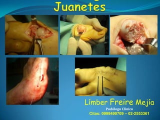 Límber Freire Mejía
Podólogo Clínico

Citas: 0999490709 – 02-2553361

 