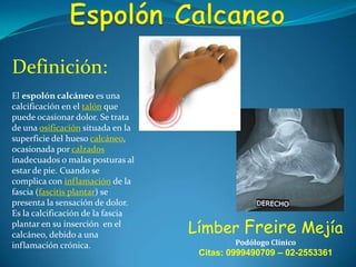 Definición:
El espolón calcáneo es una
calcificación en el talón que
puede ocasionar dolor. Se trata
de una osificación situada en la
superficie del hueso calcáneo,
ocasionada por calzados
inadecuados o malas posturas al
estar de pie. Cuando se
complica con inflamación de la
fascia (fascitis plantar) se
presenta la sensación de dolor.
Es la calcificación de la fascia
plantar en su inserción en el
calcáneo, debido a una
inflamación crónica.

Límber Freire Mejía
Podólogo Clínico

Citas: 0999490709 – 02-2553361

 