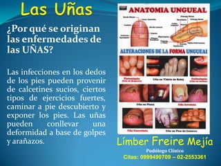 ¿Por qué se originan
las enfermedades de
las UÑAS?
Las infecciones en los dedos
de los pies pueden provenir
de calcetines sucios, ciertos
tipos de ejercicios fuertes,
caminar a pie descubierto y
exponer los pies. Las uñas
pueden
conllevar
una
deformidad a base de golpes
y arañazos.

Límber Freire Mejía
Podólogo Clínico

Citas: 0999490709 – 02-2553361

 