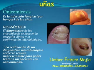Onicomicosis.
Es la infección fúngica (por
hongos) de las uñas.

DIAGNÓSTICO:
El diagnóstico de las
onicomicosis se basa en la
sospecha clínica y la
confirmación microbiológica.
• La realización de un
diagnóstico microbiológico
correcto resulta
imprescindible para poder
tratar a un paciente con
onicomicosis.

Límber Freire Mejía
Podólogo Clínico

Citas: 0999490709 – 02-2553361

 