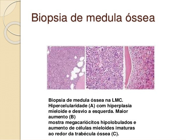 Como e feito o exame de compatibilidade de medula ossea