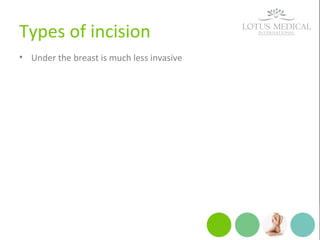 Types of incision
• Under the breast is much less invasive
 