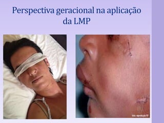 Perspectiva geracional na aplicação 
da LMP 
 