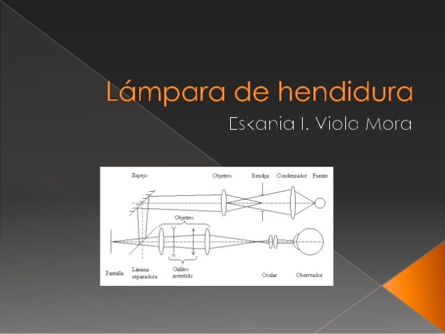 Lámpara de hendidura