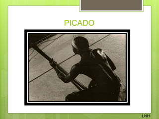 PICADO
LNH
 