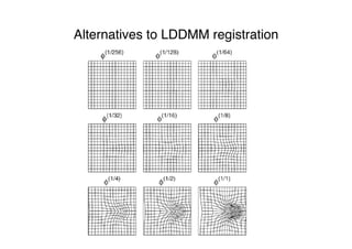 Alternatives to LDDMM registration
 