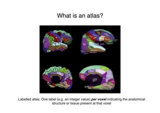 What is an atlas?
Labelled atlas: One label (e.g. an integer value) per voxel indicating the anatomical
structure or tissue present at that voxel
 