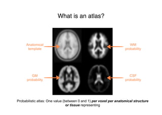 What is an atlas?
Anatomical
template
Probabilistic atlas: One value (between 0 and 1) per voxel per anatomical structure
or tissue representing
CSF
probability
GM
probability
WM
probability
 