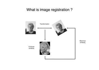 What is image registration ?
Maximize
similarity
Compute
similarity
Transformation
 