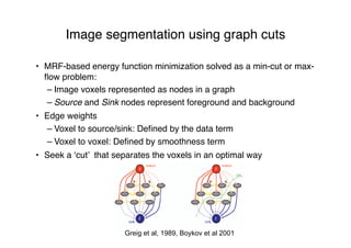 Image segmentation using graph cuts
• MRF-based energy function minimization solved as a min-cut or max-
ﬂow problem:
– Image voxels represented as nodes in a graph
– Source and Sink nodes represent foreground and background
• Edge weights
– Voxel to source/sink: Deﬁned by the data term
– Voxel to voxel: Deﬁned by smoothness term
• Seek a ‘cut’ that separates the voxels in an optimal way
Greig et al, 1989, Boykov et al 2001
 