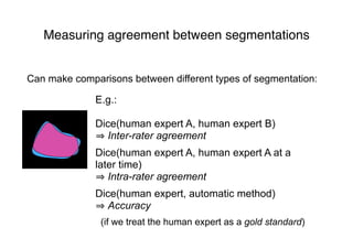Measuring agreement between segmentations
Can make comparisons between different types of segmentation:
E.g.:
Dice(human expert A, human expert B)
Inter-rater agreement
Dice(human expert A, human expert A at a
later time)
Intra-rater agreement
Dice(human expert, automatic method)
Accuracy
(if we treat the human expert as a gold standard)
 