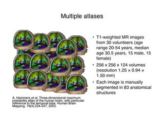 Multiple atlases
• T1-weighted MR images
from 30 volunteers (age
range 20-54 years, median
age 30.5 years, 15 male, 15
female)
• 256 x 256 x 124 volumes
(resolution 1.25 × 0.94 ×
1.50 mm)
• Each image is manually
segmented in 83 anatomical
structures
A. Hammers et al. Three-dimensional maximum
probability atlas of the human brain, with particular
reference to the temporal lobe. Human Brain
Mapping, 19(4):224-247, 2003.
 