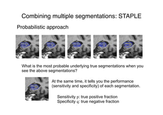 Probabilistic approach
What is the most probable underlying true segmentations when you
see the above segmentations?
At the same time, it tells you the performance
(sensitivity and specificity) of each segmentation.
Sensitivity p: true positive fraction
Specificity q: true negative fraction
Combining multiple segmentations: STAPLE
Combining multiple segmentations: STAPLE
 