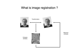 What is image registration ?
Maximize
similarity
Compute
similarity
Transformation
 