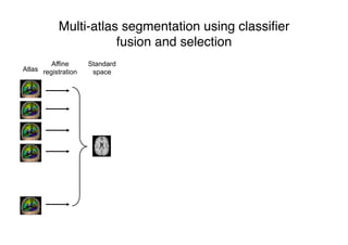 Multi-atlas segmentation using classiﬁer
fusion and selection
Atlas
Affine
registration
Standard
space
 
