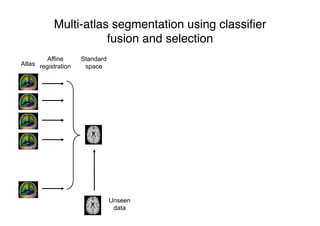 Multi-atlas segmentation using classiﬁer
fusion and selection
Atlas
Affine
registration
Standard
space
Unseen
data
 