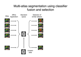 Multi-atlas segmentation using classiﬁer
fusion and selection
Atlas
Affine
registration
Standard
space
Selection of
similar atlases
X
X
Unseen
data
 